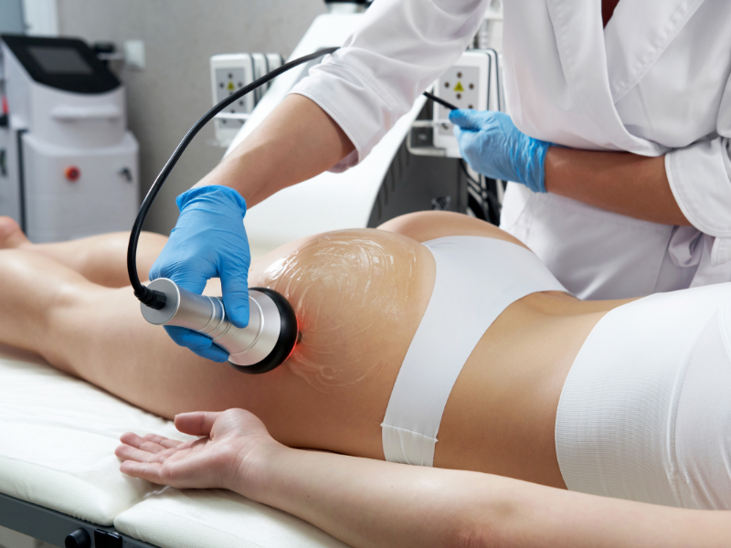Trattamento corpo con tecnologia estetica