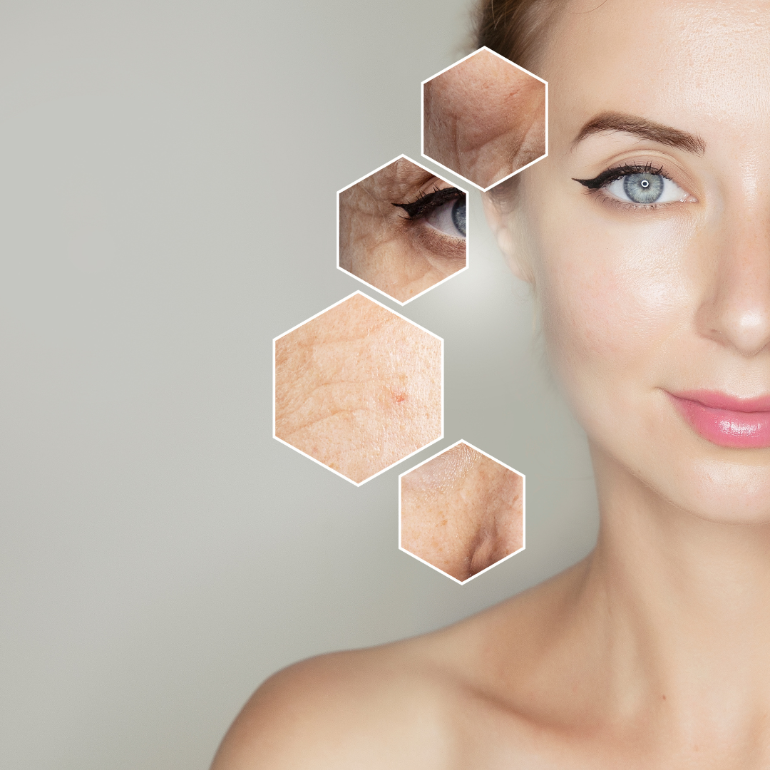 Skin test diagnostico